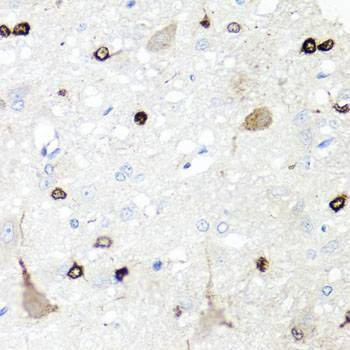 Anti-Mouse/Rat IGFBP5 Antibody