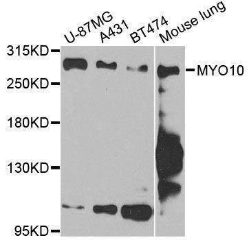 Anti-MYO10 Antibody