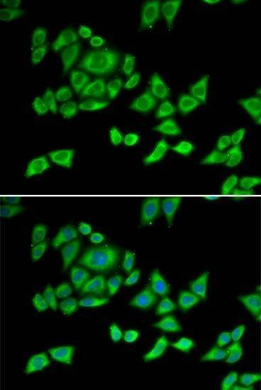 Anti-Mouse/Rat OGDH Antibody