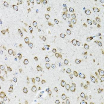 Anti-Mouse/Rat OGDH Antibody