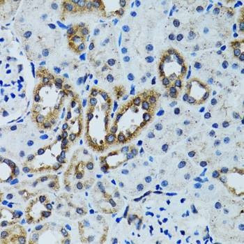 Anti-RPN1 Antibody