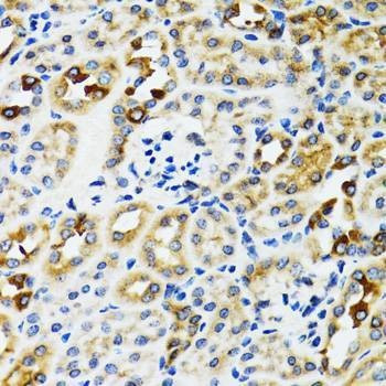 Anti-RPN1 Antibody