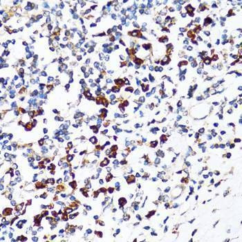 Anti-RPN1 Antibody