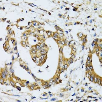 Anti-RPN1 Antibody