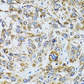 Anti-RPN1 Antibody