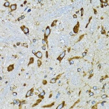 Anti-RPN1 Antibody