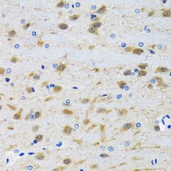 Anti-MAPK9 Antibody