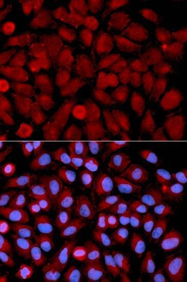 Anti-MAPK9 Antibody
