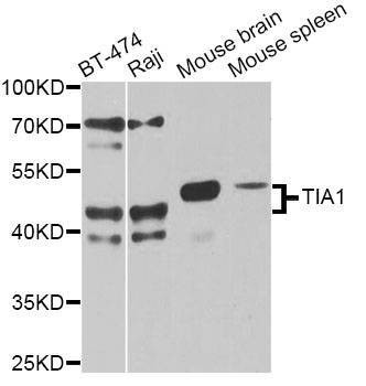 Anti-TIA1 Antibody
