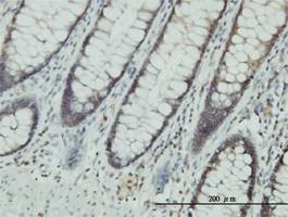 Anti-CLIC1 Antibody
