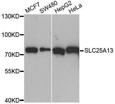 Anti-SLC25A13 Antibody