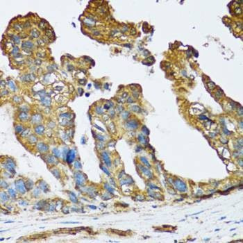 Anti-SLC25A13 Antibody