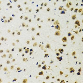 Anti-RUVBL2 Antibody