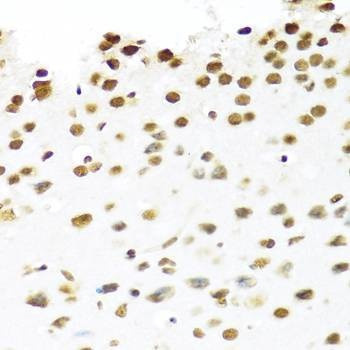 Anti-PRPF19 Antibody