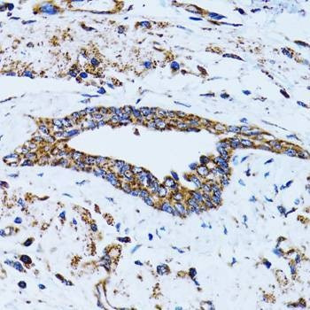 Anti-EIF2AK4 Antibody