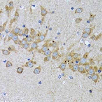 Anti-EIF2AK4 Antibody