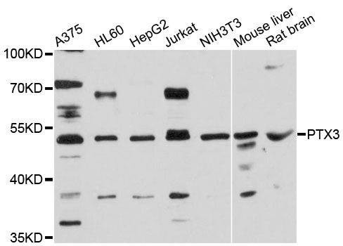 Anti-PTX3 Antibody