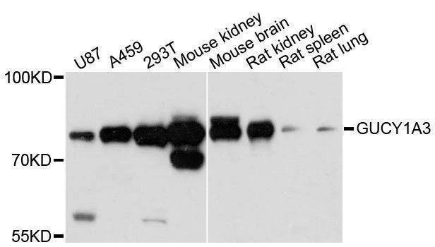 Anti-GUCY1A3 Antibody