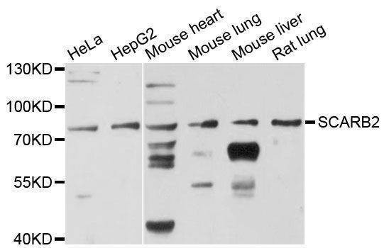 Anti-SCARB2 Antibody