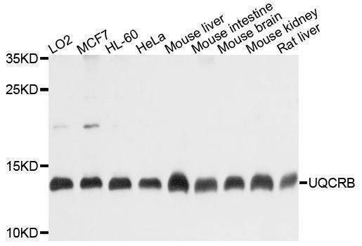 Anti-UQCRB Antibody