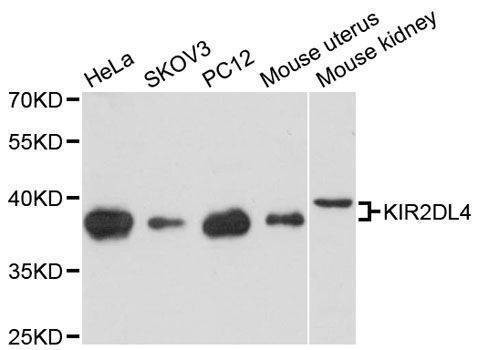 Anti-KIR2DL4 Antibody