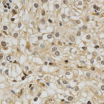 Anti-GSTT1 Antibody