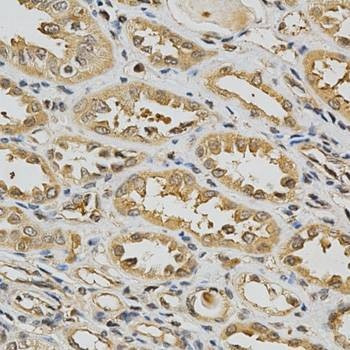 Anti-GSTT1 Antibody