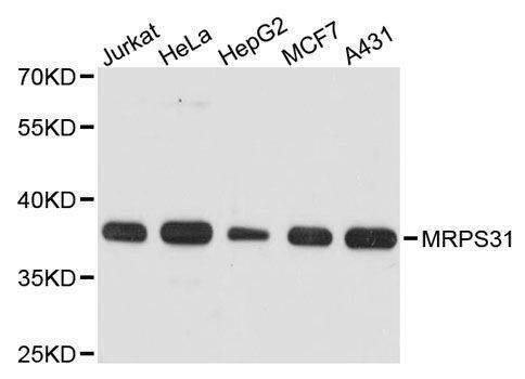 Anti-MRPS31 Antibody