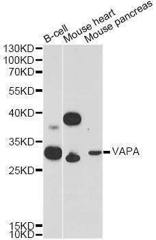 Anti-VAPA Antibody