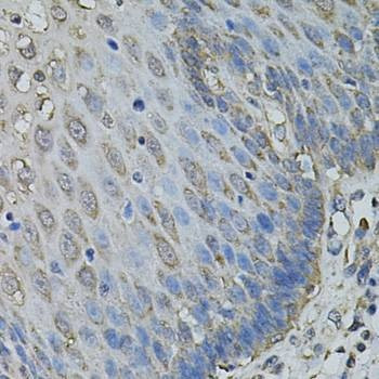 Anti-IL1A Antibody
