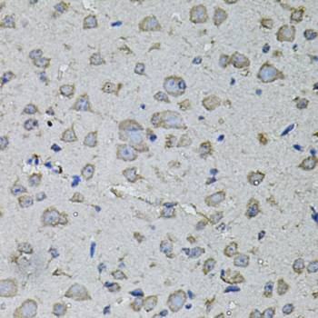 Anti-IL1A Antibody