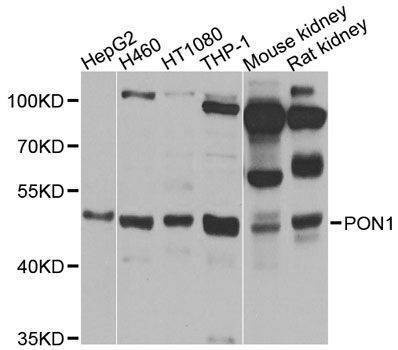 Anti-PON1 Antibody