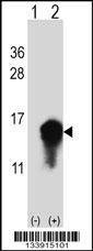 Anti-CSTA (C-term) Antibody