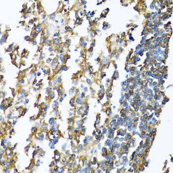Anti-HLA-DPB1 Antibody