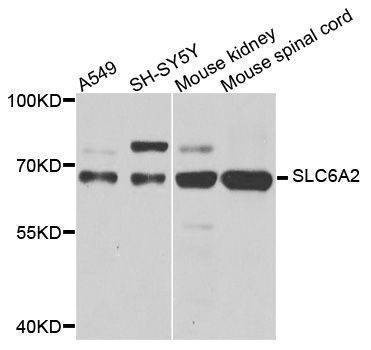 Anti-SLC6A2 Antibody