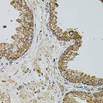 Anti-SELP Antibody