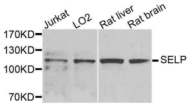 Anti-SELP Antibody