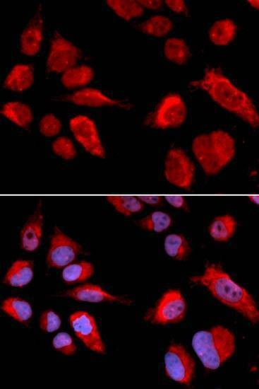 Anti-CBS Antibody