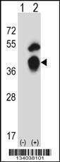 Anti-GTF2B (N-term) Antibody