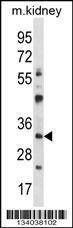 Anti-GTF2B (N-term) Antibody