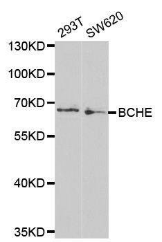 Anti-BCHE Antibody