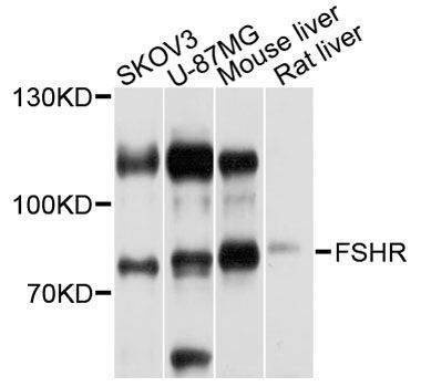 Anti-FSHR Antibody