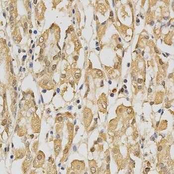Anti-PRDX4 Antibody