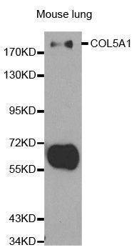 Anti-COL5A1 Antibody