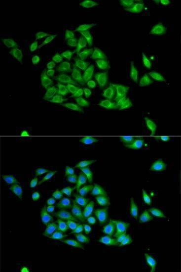 Anti-PICK1 Antibody