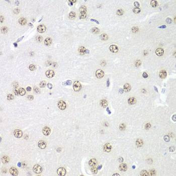 Anti-PRMT5 Antibody