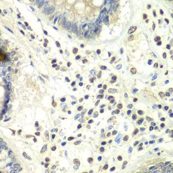 Anti-PRMT5 Antibody