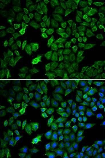 Anti-PRMT5 Antibody