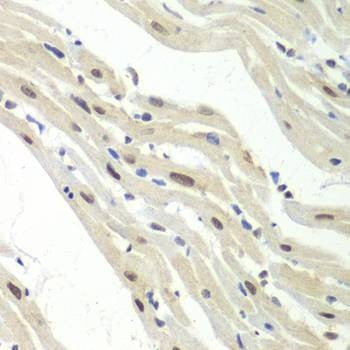 Anti-UPF1 Antibody
