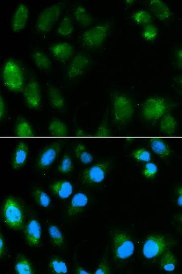 Anti-UCP3 Antibody
